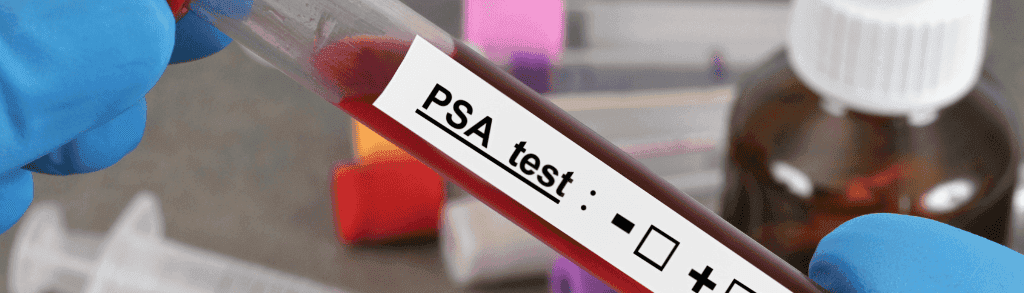 Prostate cancer screening blood work