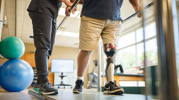 Physical therapist assisting a man with a prosthetic leg during rehabilitation exercises using parallel bars.